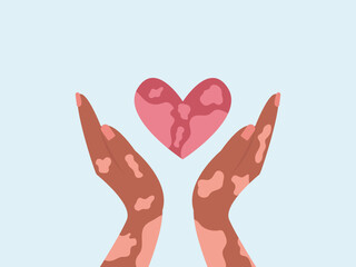 Two hands with suffering from leprosy disease holding heart show care and support. vector illustration