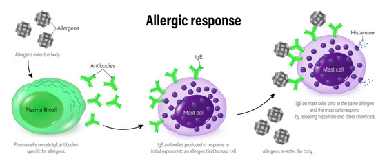 Allergic response. Allergic reaction. Mechanism of allergy. The human immune system.