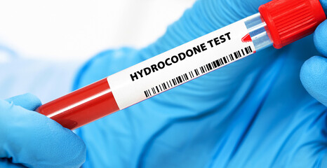 Obraz premium Hydrocodone Test