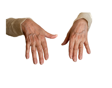 Elderly woman hands. Senior old lady experiencing severe arthritis rheumatics pains, massaging, wrinkles, veins, warming up arm. Close-up PNG