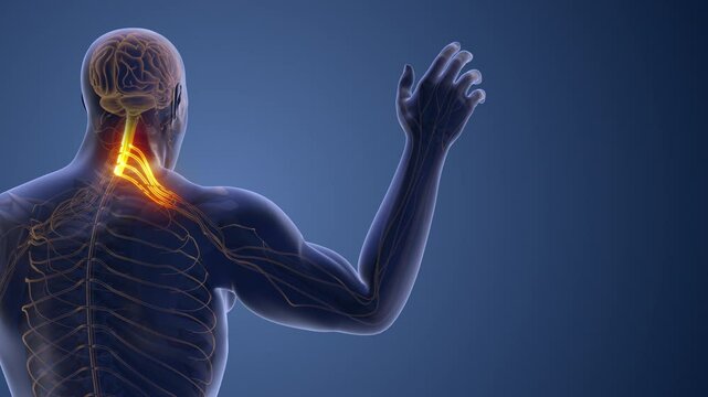 Compressed Cervical Nerve Leading to Radiating Pain
