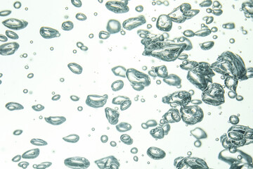 Many water bubbles on light background, closeup