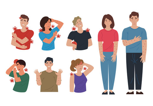 Colorful Monkey Pox Virus Disease Medical Illustration Set