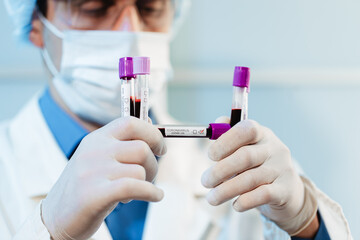 A virologist doctor is examining a sample of a blood test with suspected Covid-19 virus.