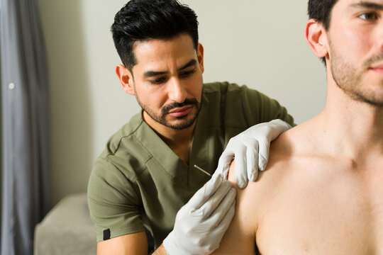Latin physiotherapist performing dry needling technique on male patient's shoulder to alleviate pain and promote healing