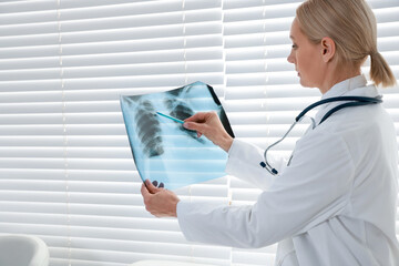 Doctor examining x-ray image of lungs in clinic, space for text