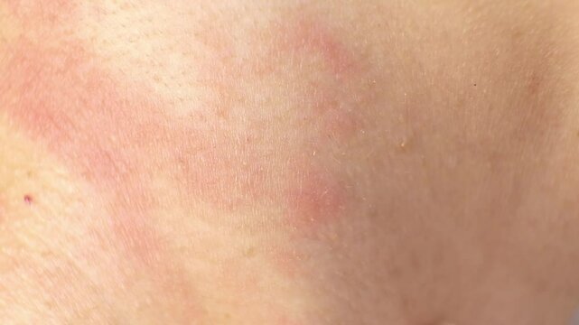 Extreme close-up of irritated neck skin. Highlights concerns about allergies, skin disorders, and personal care.
