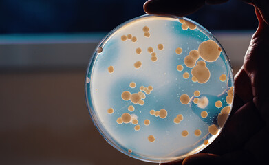 Petri dish with bacterial colonies. Experiment on studying. Microflora.