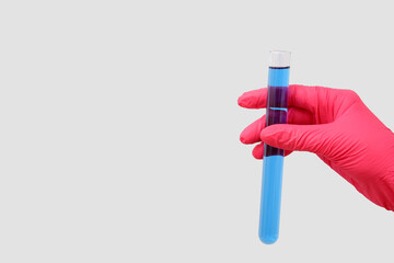 Lab's worker hand with test tube of sample on grey background