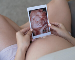 Pregnant woman holding 3d photo of baby with ultrasound. 