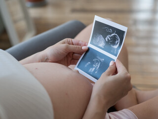 Pregnant woman holding baby ultrasound photo. 