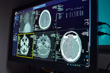 Medical imaging results displayed on an advanced screen, showcasing detailed brain scans and...