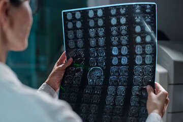 Medical professional analyzing series of brain scans for identifying potential neurological issues...