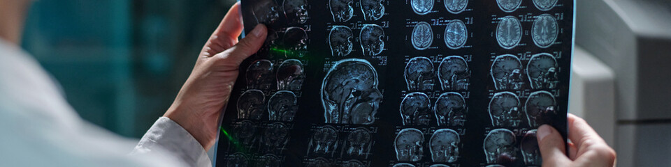 Medical professional in white coat examining detailed brain scans on transparent lightboard in...