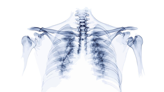 A grayscale image depicting a posterior (rear) view of a human thorax and shoulder anatomy. The image is stylized to appear as a radiographic or x-ray image, with a transparent effect showcasing
