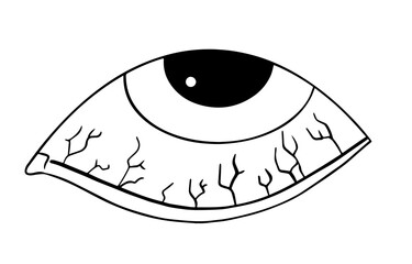 eye with visible blood vessels, indicating irritation, fatigue, symptoms of eye infections like conjunctivitis, with red, inflamed sclera. Uveitis. Dry eye syndrome. Glaucoma.  Allergies. Subconjuncti