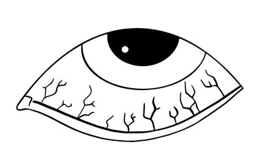 Close-up of eyes with blood vessels visible in the sclera, indicating fatigue, irritation, symptoms of an eye infection,diseases, conjunctivitis,Uveitis. 
Dry eye syndrome. Glaucoma. Allergies. Subcon