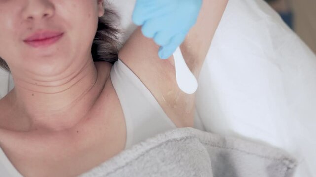 Selective focus underarm with applies a cooling gel using a spatula by skincare specialist. preparing for a laser hair removal procedure.