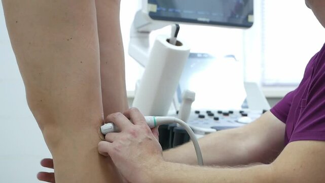A close-up of a diagnostic doctor performs an ultrasound examination of the leg veins of a sick patient. Diagnosis and treatment of blood clots and plaques in the veins of people with high cholesterol
