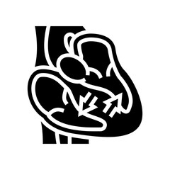 Fototapeta premium hypertrophic cardiomyopathy cardiology glyph icon vector illustration