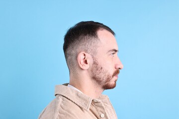 Obraz premium Baldness problem. Man with receding hairline on light blue background
