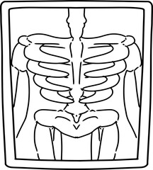 hand drawn xray