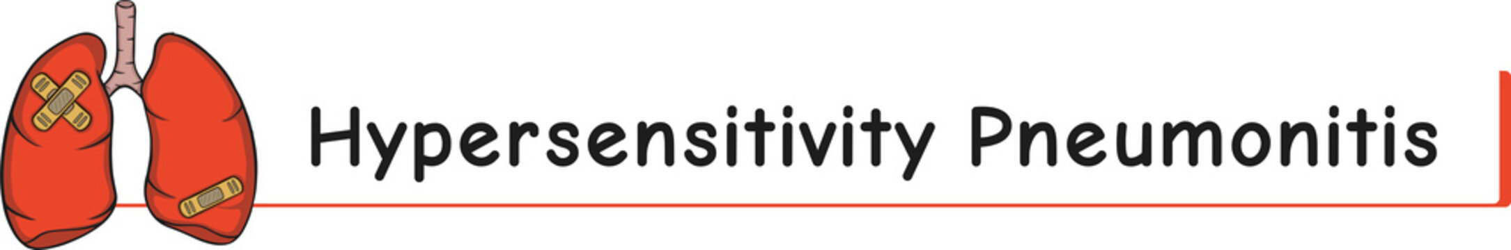 lung disease hypersensitivity pneumonitis
