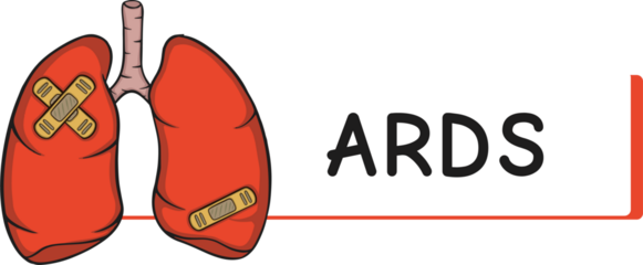 lung disease ards