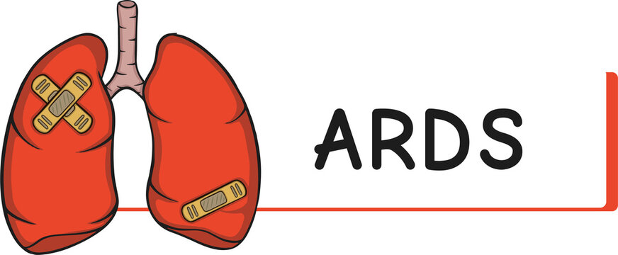 lung disease ards