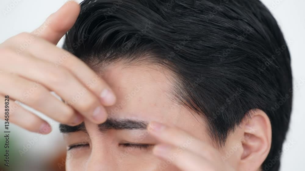 Poster 薄毛、ニキビ、男性、悩む、AGA、抜け毛、おでこ、生え際、はげ、チェック、育毛、ヘアケア、治療、後退、脱毛、脱毛症、男性ホルモン、M字、ヘアサイクル、DHT、クリニック、スキンケア、ニキビケア、アクネケア、悩み、困る、トラブル、問題、肌荒れ、メンズ、エステ、日本人、ストレス、ライフスタイル、美容、ビューティー、美肌、美顔、セルフケア、お手入れ、確認、若い、若ハゲ、気になる、心配、不安、不満、フェイ