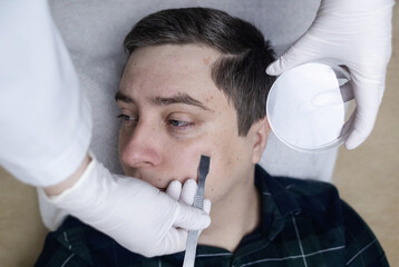 A dermatologist takes a skin scraping test for demodicosis and dermatitis, fungal infection....