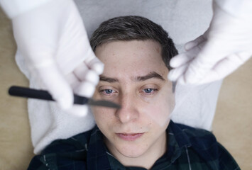 Fototapeta premium A dermatologist takes a skin scraping test for demodicosis and dermatitis, fungal infection. Close-up of a male patient's face at a doctor's appointment