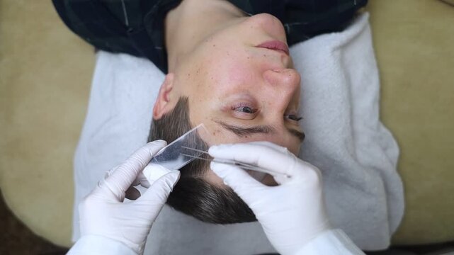 A dermatologist uses tweezers to take a scraping of a male patient's eyebrows for a demodex test. Dermatological examination and diagnosis of skin parasites and mites.