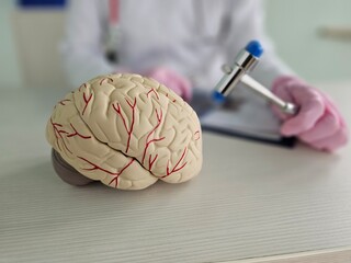 A brain model highlighting the vascular system is placed on a table. A medical professional wearing...