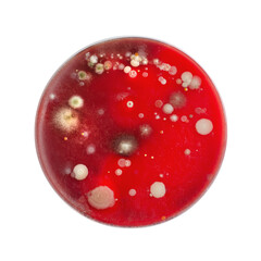 Bacterial and mold fungi colonies grown from indoor air on blood sheep agar