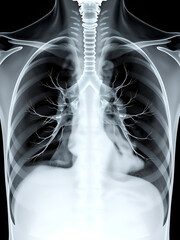 Ultra-Detailed 3D X-ray of Human Lungs with Alveoli and Bronchial Tubes