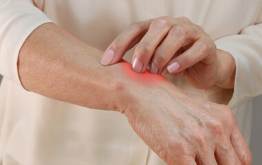 피부를 긁고 있다 - 건선, 피부병