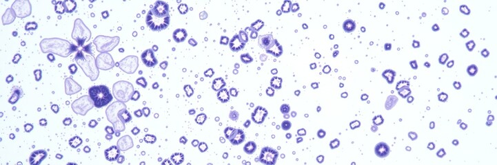 PAS Stain Microscopic Sample with Ample Space for Text