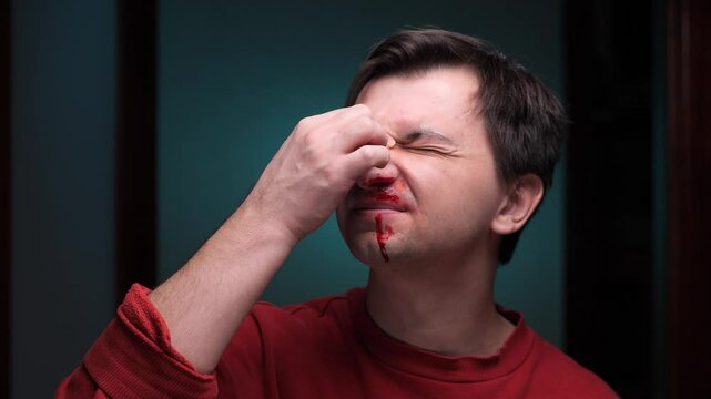 Man suffering nosebleed pinching his nose with a tissue