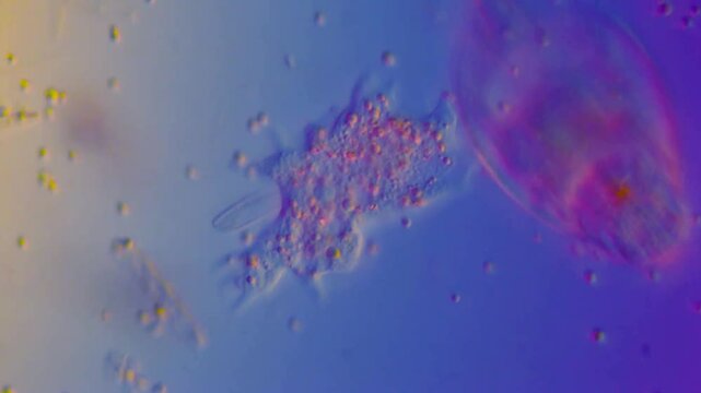 Microscopic life in freshwater under DIC microscope