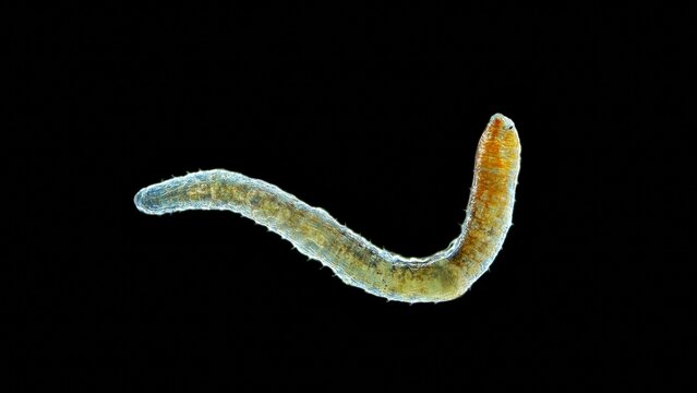 Worm Nais sp. under a microscope, family Naididae, a class of Oligochaeta, feed on plant foods (algae) and the remains of dead organisms, sometimes protozoa. Lake Baikal