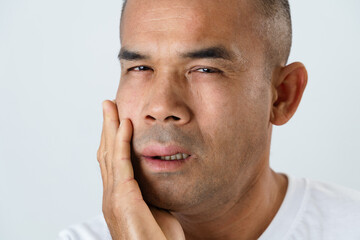 The man has facial swelling due to an allergic reaction to triggers such as insect bites stings.