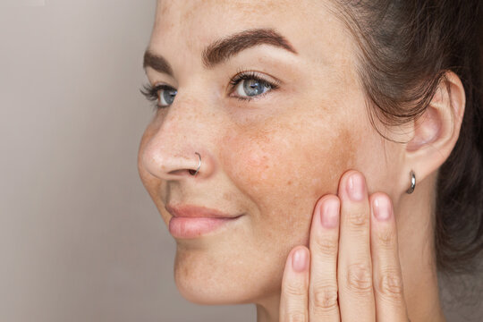 Pigmentation Images – Browse 63,698 Stock Photos, Vectors, and Video |  Adobe Stock