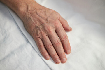 Close-up of an elderly hand resting on a white surface, focusing on the details of skin and texture...