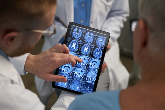 Medical professionals analyzing detailed brain scans on tablet device screen during consultation session, showing close cooperation in diagnostic process