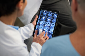 Medical professionals in white coats examining brain scan results on tablet