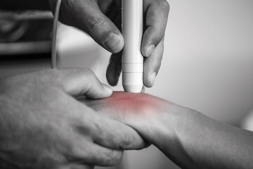 Physical therapist performs laser therapy on a patients wrist, targeting pain relief and promoting...