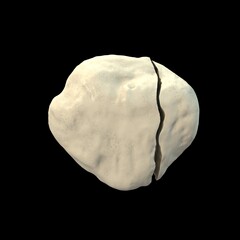 Patella vertical fracture, 3D illustration showing a lengthwise break in the kneecap, affecting knee stability and movement.