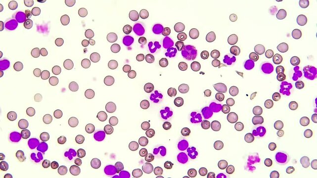 Blood smear under microscope view 