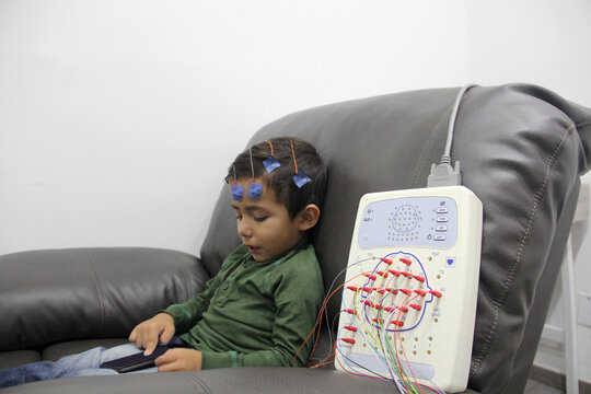 EEG electroencephalogram of a 3-year-old Latino boy with cables and electrodes attached to the head to record the electrical activity of the brain and diagnose autism